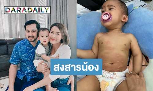 ต้องระวัง! “น้องวิน” ลูก “แม่หนูเล็ก” แพ้แป้งสาลี อาการเป็นแบบนี้