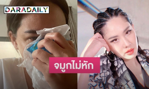"นุ้ย สุจิรา" เผยหลังเอ็กซเรย์จมูกเหตุถูก "น้องรพี" จระเข้ฟาดหางที่หน้า