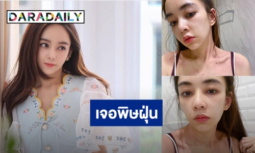 “เป้ย ปานวาด” ออกไปวิ่งแปปเดียว แพ้ฝุ่นหนักแดงเกือบทั้งตัว!