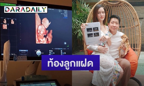 “จุ้มจิ้ม” ภรรยา “ภัทร จึงกานต์กุล” ประกาศข่าวดีท้องลูกแฝด ชมสามีดูแลดีเวอร์