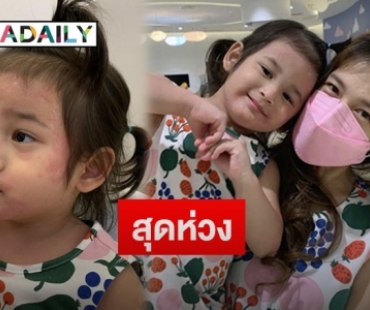 “กระแต เสาวคนธ์” เผยหลัง “น้องมียา” เป็นลมพิษมีผื่นขึ้นลามทั้งตัว