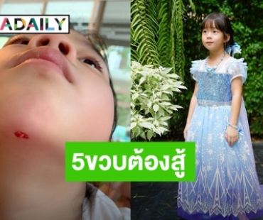 5ขวบต้องสู้! “น้องเป่าเปา” ล้มคางแตกเย็บ 4 เข็มฟาดเคราะห์ก่อนวันเกิด