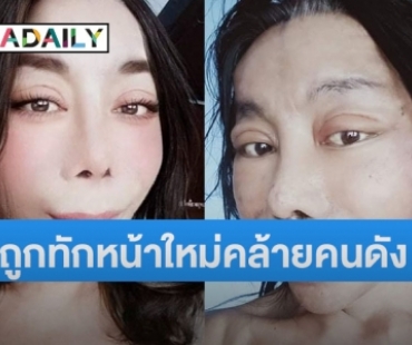 “แม่สิตางศุ์” อวดภาพล่าสุดหลังทำศัลยกรรม ทำชาวเน็ตเทียบดาราคนนี้