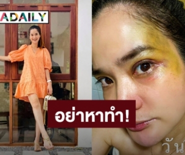 อย่าหาทำ! “ปอย ปวีณา” เล่นสเก็ตบอร์ดไม่ใส่เครื่องป้องกัน หน้าฟาดพื้นไม่รู้ตัว
