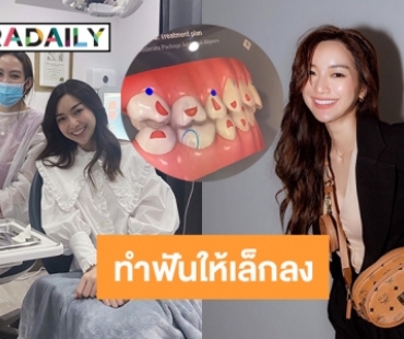 ยิ้มมั่นใจ “น้ำหวาน ภูริตา” ทำฟันให้เล็กลงใช้เวลาปีกว่า