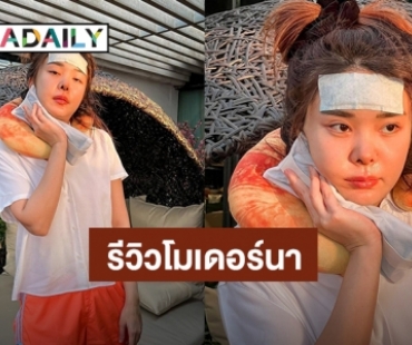 “หญิงแย้” รีวิวฉีดวัคซีนโมเดอร์น่า เข็ม 3 สภาพคือตุยเย่