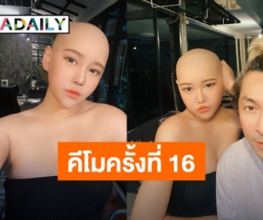 ยังยิ้มได้! “นุ๊กซี่” หวานใจ “ปู แบล็คเฮด” ให้คีโม 16 ครั้ง เผยอาการข้างเคียงมือดำ ตัวบวม หน้าบวม