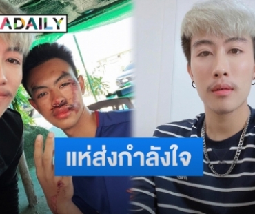 “นุ๊ก ธนดล” โพสต์ภาพน้องชายประสบเหตุ ฟาดเคราะห์ส่งท้ายปี