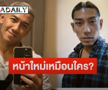 ยลโฉม “ป๋อมแป๋ม” หลังขึ้นเขียงศัลยกรรมใบหน้า