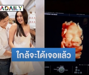 “เตย กัญญกร” โชว์ภาพอัลตราซาวด์ลูกสาวตัวน้อย พร้อมเผยชื่อสุดน่ารัก