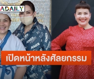 ปังมาก!! เปิดภาพ “แหม่ม สุริวิภา” หลังขึ้นเขียงทำศัลยกรรม 