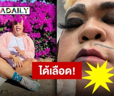 หลังวาเลนไทน์ก็ได้เลือด!! “ปิงปอง” ผิดคิวกลางกอง เฉาะคางแผลบะเร่อ!!