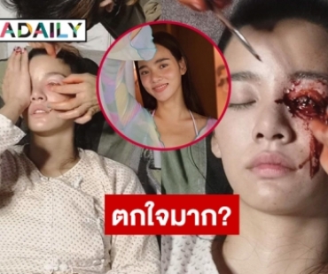 เกือบต้องควักลูกตา “วาววา” ตกใจมาก?