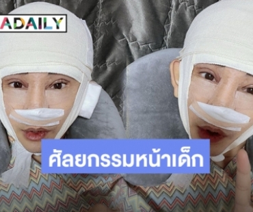 “พชร์ อานนท์” อวดศัลยกรรมรอบใหม่ หน้าเด็กลงไป 20 ปี โนสนคนบูลลี่