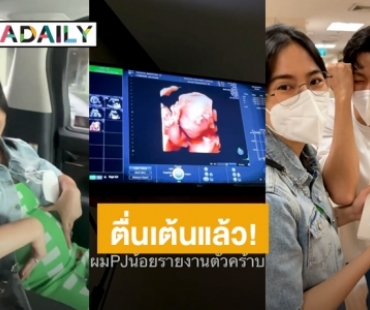 “พุฒ-จุ๋ย” โชว์อัลตร้าซาวด์ “PJน้อย” คุณพ่อคุณแม่ป้ายแดงตื่นเต้นสุดๆ