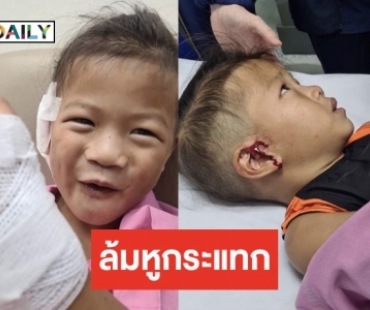 ใจแม่แทบร่วง! “ฮารุ” สงสารลูกชาย “น้องเอเดน” เย็บ 25 เข็ม