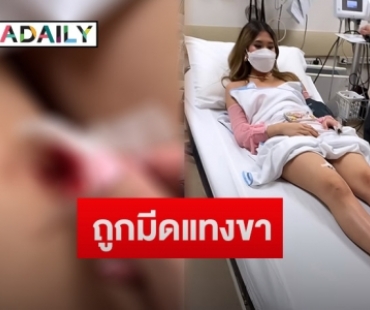 “มิย่า” ลูก “พีท ทองเจือ” ซนจนได้เลือด ถูกมีดแทงขา