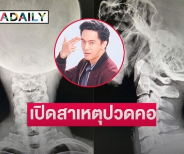 แฟนๆ ส่งกำลังใจ “จอร์จ ฐปนัท” ต้องพักยาวเพราะเหตุนี้