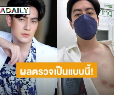 ผลตรวจเป็นแบบนี้! “ฟิล์ม รัฐภูมิ” ตรวจเช็คร่างกายหลังผ่าตัดลิ้นหัวใจรั่วระยะสุดท้ายครบ 3 เดือน 