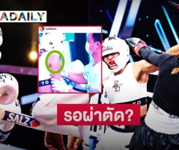  “โย” ขอโทษทุกคนคาดไหล่หลุดรอผ่าตัด