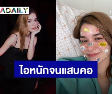 “วี วิโอเลต” เส้นเสียงบวมไอจนนอนไม่ได้ สุดท้ายจบที่เตียงโรงพยาบาล