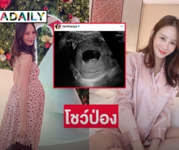 โชว์ป่อง “ตาล กัญญา” ว่าที่คุณแม่ดารา 7 สี 