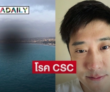 โรค CSC  รุม “เต้ วิทย์สรัช” ดวงตามองเห็นแบบนี้