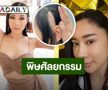 สุดช้ำใจ! “น้ำเพชร” ศัลยกรรมทำพิษ เตือนแฟนคลับให้คิดดีๆ ก่อนทำ