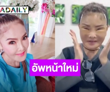 “ดาว มยุรีย์” เผยหน้าสดผ่าตัดดึงหน้า ลดอายุ ครบ 3 วัน