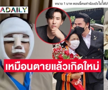 เปิดหน้า “น้องเอ” ทหารหญิงรับใช้ถูกทารุณ ที่ถูก “หนุ่ม กรรชัย” ยื่นมือเข้าช่วย ตอนนี้หายใจเองได้ 70% แล้ว