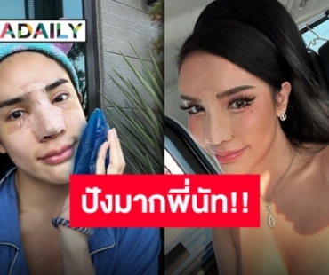 “นิสามณี” รีวิวอย่างเริ่ด ความเจ็บปวดแลกความสวยงาม ดั้งใหม่ปังจริง!!