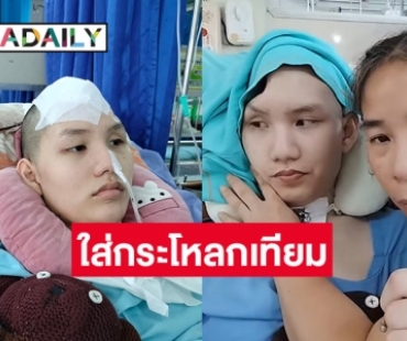 ผ่าตัดสำเร็จ “อ๊อฟ ธนกฤต” ใส่กระโหลกเทียมแล้ว