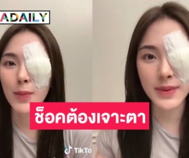 ช็อคต้องเจาะตา “ปันปัน สุทัตตา” เป็นกุ้งยิงอาการหนักกว่าปกติบอกเลยเจ็บมากๆ