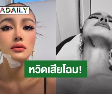 หวิดเสียโฉม! “กระแต อาร์สยาม” ฟาดเคราะห์แรง ลื่นล้มคางแตกเย็บ 5 เข็ม