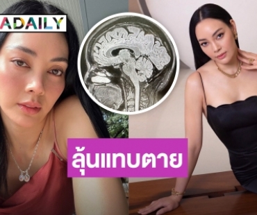 ลุ้นแทบตาย! “ตั๊ก บงกช” เปิดภาพ MRI สมอง สาเหตุทำปวดหัวหนัก