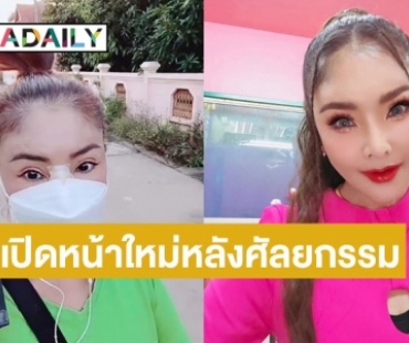 เปิดหน้าใหม่ “ดาว มยุรี” หลังศัลยกรรมจมูกใหม่ในรอบ 20 ปี