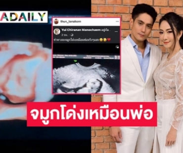 “ธัญญ์ ธนากร” เห็นหน้าลูกแล้ว “ยุ้ย” มาแซว จมูกโด่งเหมือนพ่อเลย