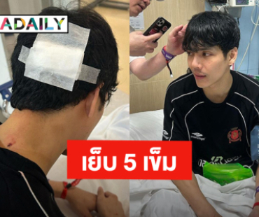 สงกรานต์วันแรก! “นิกกี้ ณฉัตร” ส่งโรงพยาบาลทำแผลเย็บ 5 เข็ม