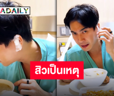 สิวสร้างเรื่อง “อปป้ามาวิน” แอดมิทผ่าหูเหตุบีบสิวจนติดเชื้อ!