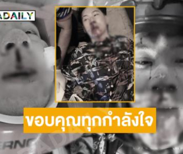 “ตั้ม วราวุธ” เผยภาพหลังถูกชนขอขอบคุณทุกกำลังใจ