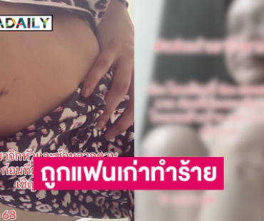 นางเอก MV เพลงดัง แฉโดนแฟนเก่า ลูกอดีตตำรวจใหญ่ทำร้ายร่างกาย