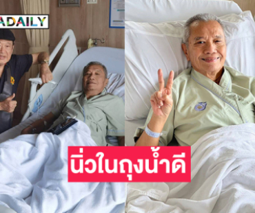 “พ่อรอง เค้ามูลคดี” เผยพบนิ่วในท่อรอแพทย์ผ่าตัด