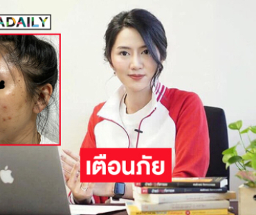 อดีตผู้ประกาศข่าวสาวหลายช่องเตรียมร้องปคบ. ถูกหมอกระเป๋าฉีดสารปลอมแจ้งความ 4 เดือนคดีไม่คืบ