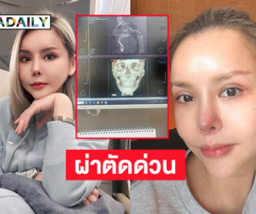 จมูกติดเชื้อพีดีคนดังต้องผ่าตัดด่วน