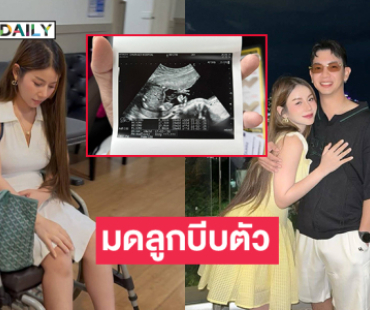 ครูอินฟลูดังเกิดภาวะ “มดลูกบีบตัว” ต้องใส่ผ้าพยุงครรภ์ 