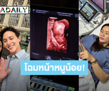 “เจมส์ จิรายุ” อัปเดต “โฟม” ท้อง 23 สัปดาห์ น้ำหนักขึ้น 10 กิโล พร้อมโชว์ภาพอัลตร้าซาวด์ลูกแบบ 3D