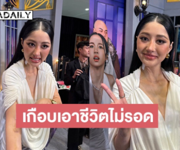 ไม่ใช่คอนเทนต์! “มิ้วกี้ ไปรยา” เล่าเกือบเอาชีวิตไม่รอดเพราะติดเชื้อในกระแสเลือด 