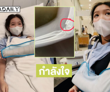 กำลังใจ “น้องอินเตอร์” หลังล้มแขนหักต้องพักละคร