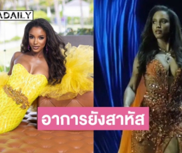 อัปเดตอาการ “มิสยูนิเวิร์สจาเมกา 2025” ตกเวทีรอบพรีลิม ยังสาหัส มีเลือดออกในสมอง