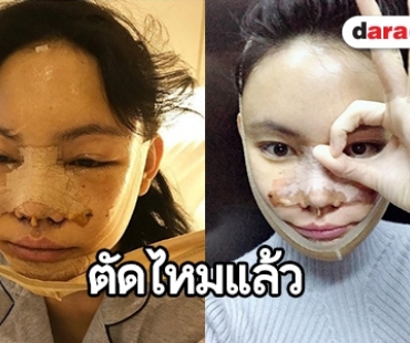 ส่องหน้า “เอมมี่ แม็กซิม” โครง “แม่ชม” มาหรือยัง?